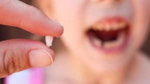 Mimpi Gigi Copot: Makna, Mitos, dan Penjelasan Menurut Islam